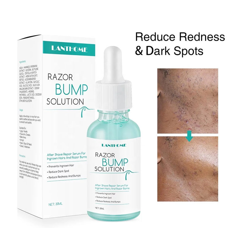 LANTHOME Razor Bump Solution For Ingrown Hair