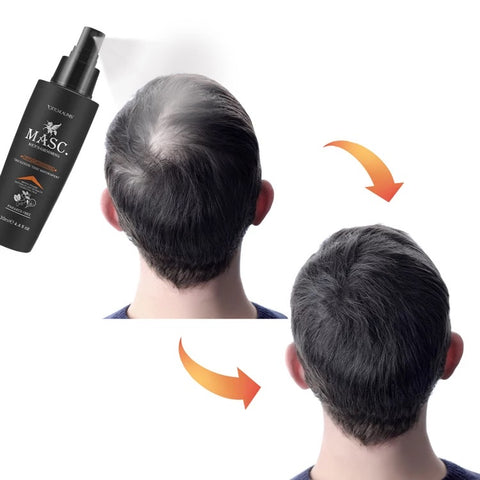 New Touch 3 Pcs Set Anti-Hair Loss Thickening System for Men 300ml