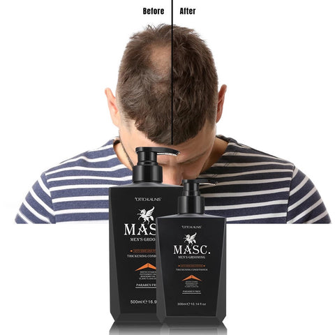 New Touch 3 Pcs Set Anti-Hair Loss Thickening System for Men 300ml